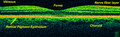 റെറ്റിനയുടെ മാക്യുലാർ ഏരിയയുടെ ടൈം-ഡൊമെയ്ൻ OCT, 800 nm, അക്ഷീയ മിഴിവ് 3 µm