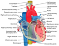 Imagine care arată artera pulmonară principală care se desfășoară ventral spre rădăcina aortică și traheea, iar artera pulmonară dreaptă trece dorsal către aorta ascendentă, în timp ce artera pulmonară stângă trece ventral către aorta descendentă⁠(d) .