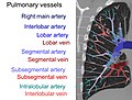 Tomografia computerizată⁠(d) a unui plămân normal, cu diferite niveluri de artere pulmonare.
