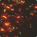Imaxe de FISH con etiquetado dual; Bifidobacterias Cy3, bacterias totais FITC.