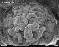 Glomerulus im Rasterelektronenmikroskop (REM) Bildbreite ca. 115 µm