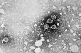 TEM мікрофотографія віріонів вірусу гепатиту B