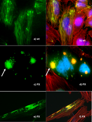 Microscopia de fluorescencia da expresión de ADN no tipo salvaxe humano e no mutante P239S da paladina.