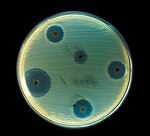 培地上での実験。抗生物質を含むディスクでは、黄色ブドウ球菌の繁殖が抑制される。菌が繁殖していない円形の部分を阻止円と呼ぶ。
