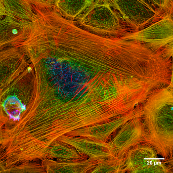 Snímek fluorescenční mikroskopie zachycující aktinová mikrofilamenta, která jsou částí cytoskeletu buňky