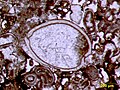 Image 2Articulated ostracod valves in cross-section from the Permian of central Texas; typical thin section view of an ostracod fossil (from Ostracod)