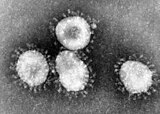 HCoV-229E 바이러스