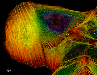 A z-projection of an osteosarcoma cell, stained with phalloidin to visualise actin filaments. The image was taken on a confocal microscope, and the subsequent deconvolution was done using an experimentally derived point spread function.