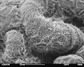 Mišji glomerul pod skenirajućim elektronskim mikroskoom (uvećanje od 5.000x)