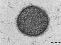B. subtilis sejt keresztmetszetének transzmissziós elektronmikroszkópos felvétele (a skála beosztása 200 nm).