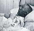 Ephraim Beard with smallpox. Died on 13 April 1896