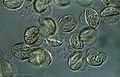 マツ属花粉の光学顕微鏡写真