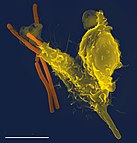 Neutrophil (right) engulfing anthrax bacteria (left)